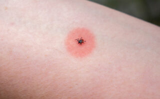 Hogyan szabaduljunk meg a pelustól?